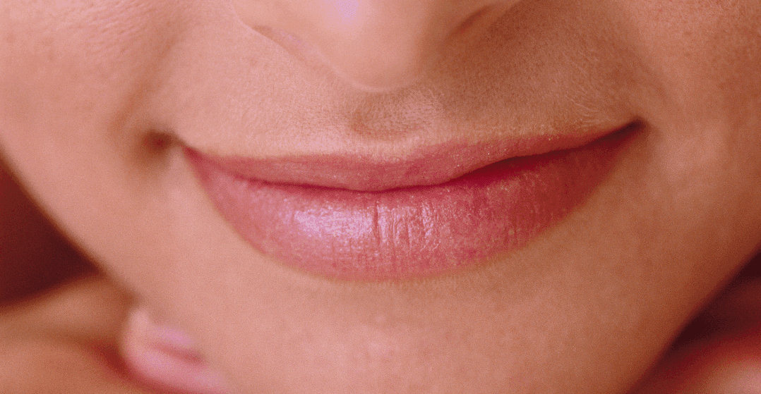 Lip-Fillers-closeup