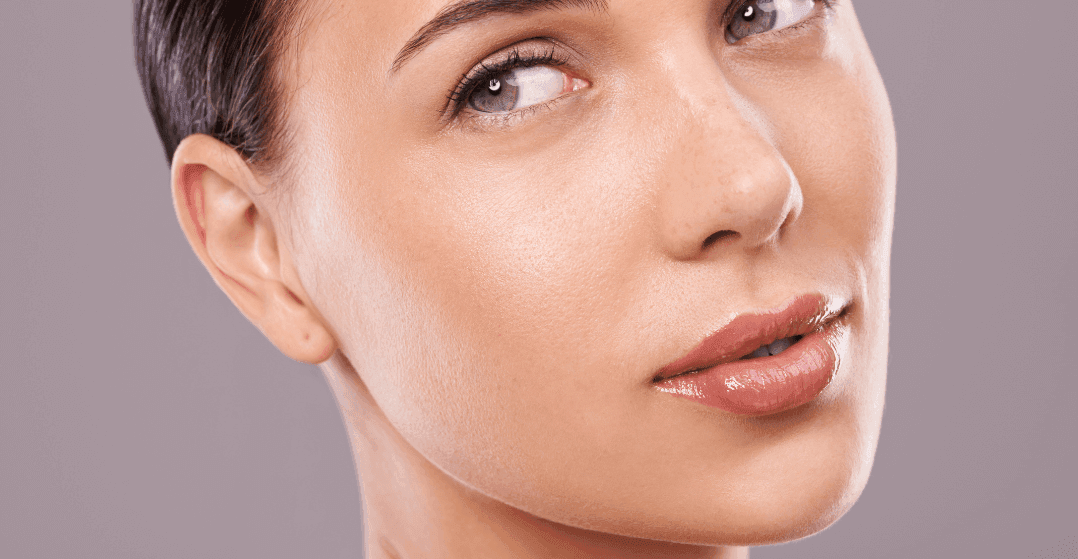 Microneedling-Acne-Scarring