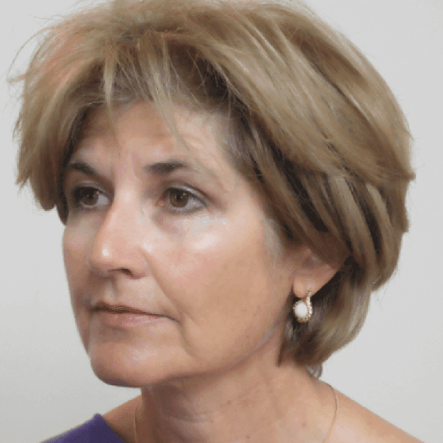 Silhouette-soft-after-harleystreet