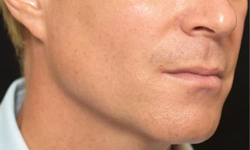 julaine-b&a-man