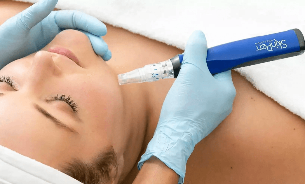 skinpen-female-treatment