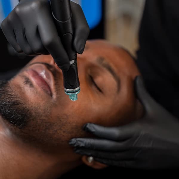 hydrafacial-for-men