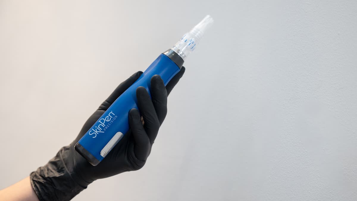 Microneedling-skin-pen
