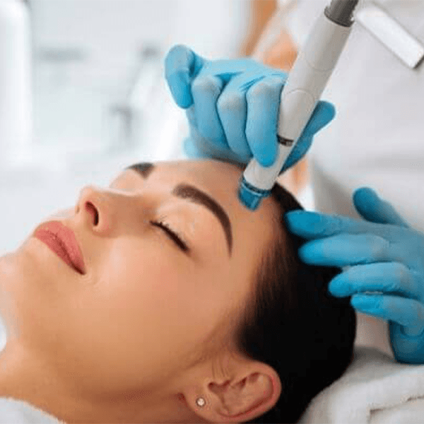 laser-treatment-forehead