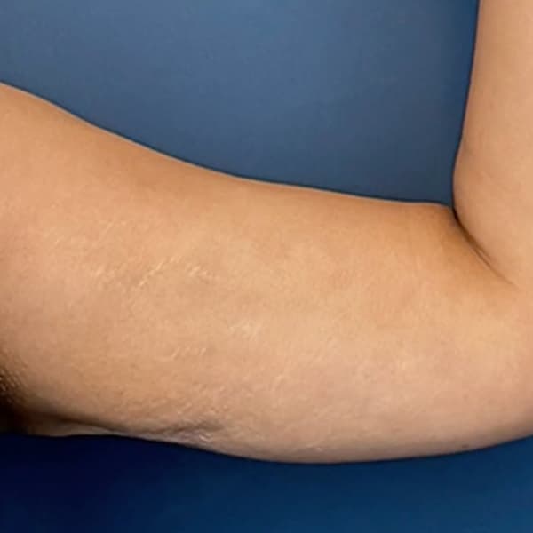 under-arm-