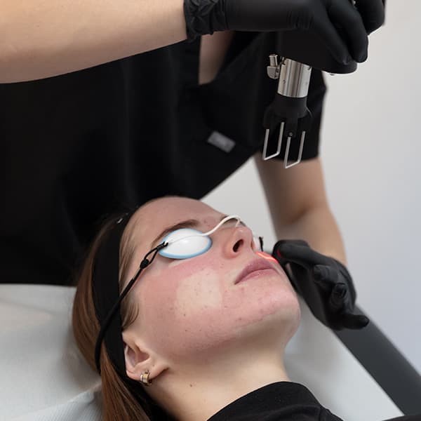 coolpeel-harley-street