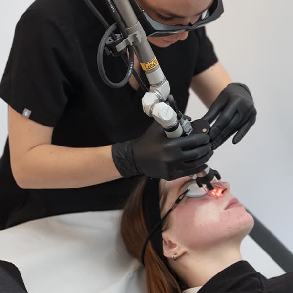 cool-peel-pico-laser-harleystreet