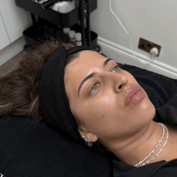 Before-Hydrafacial