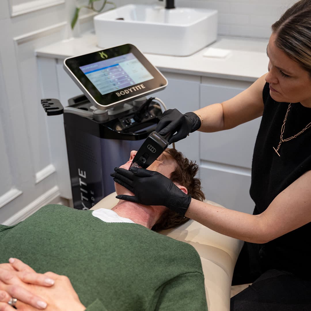 morpheus8-treatment-latelier-aesthetics