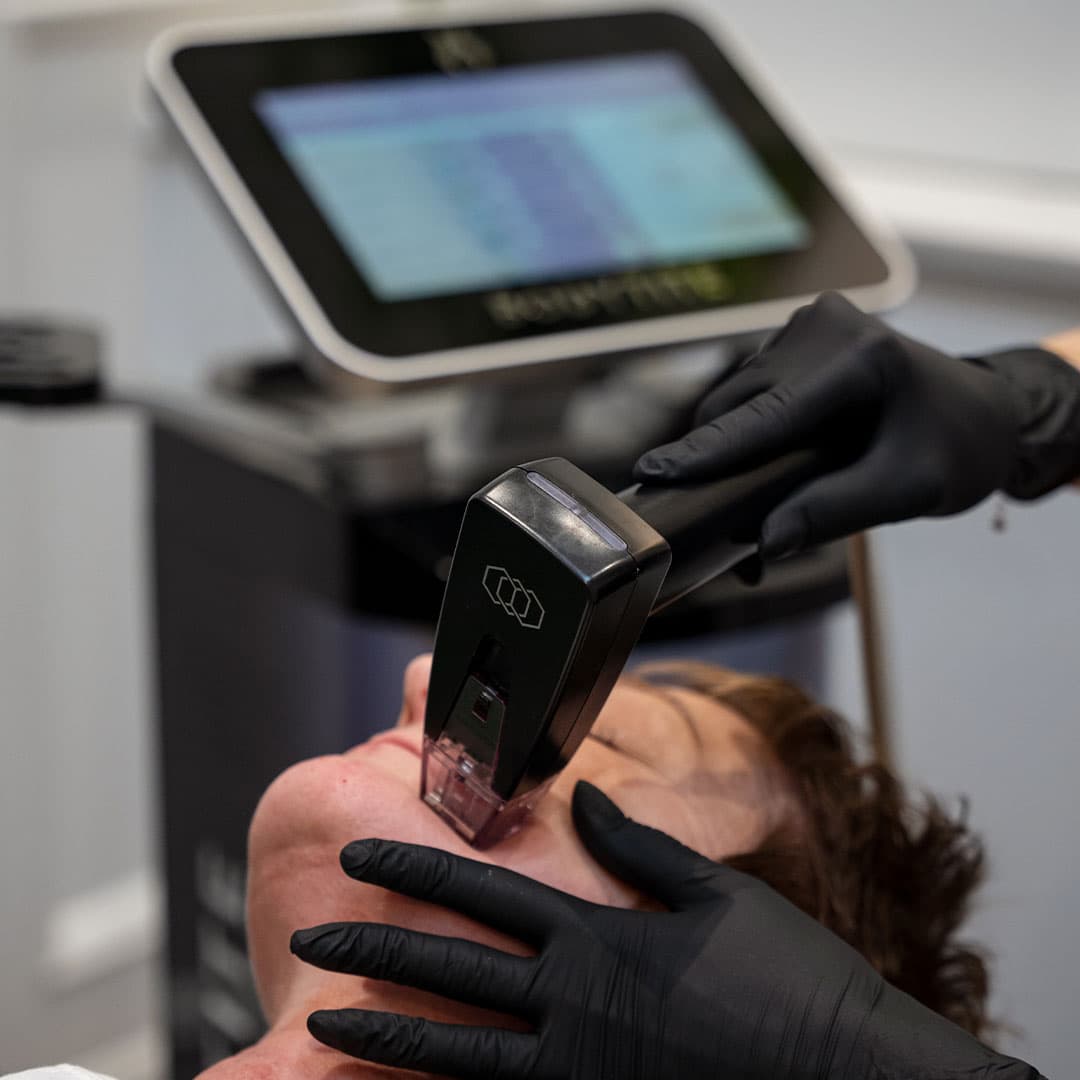 morpheus-8-harley-st