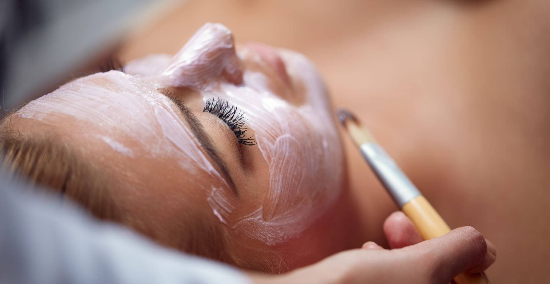 chemical-peel-treatment