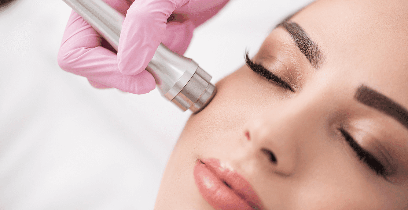 micro-needling