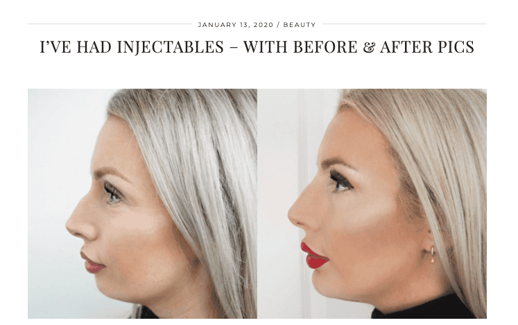 before-after-devoted-to-pink