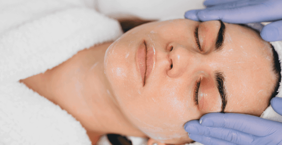 chemica-peel-face