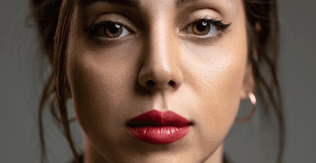 dermal-fillers-fixing