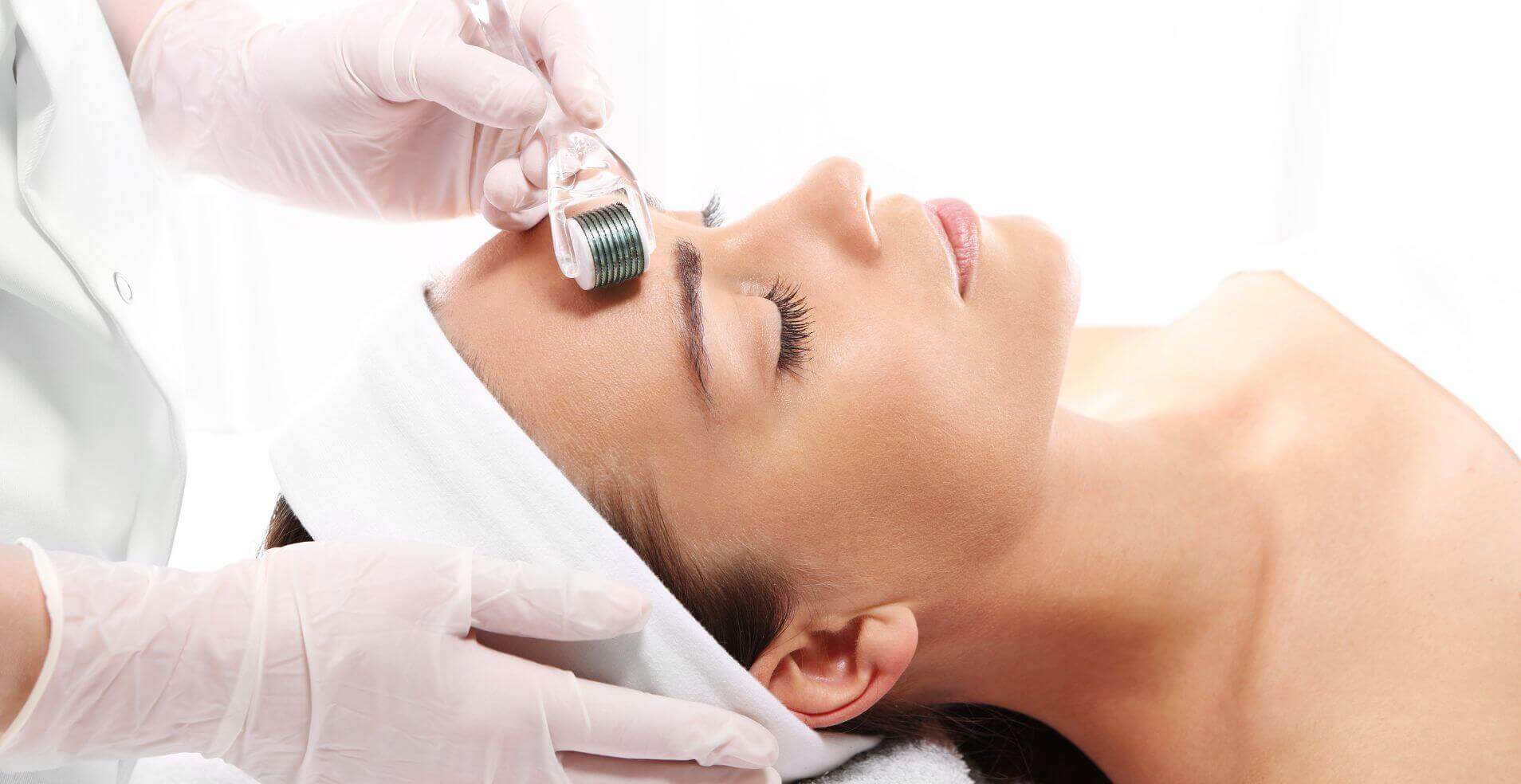 microneedling-forehead