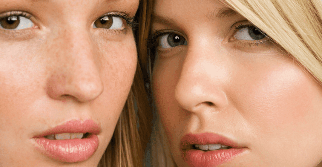 Women-clear-skin-after-morpheus8