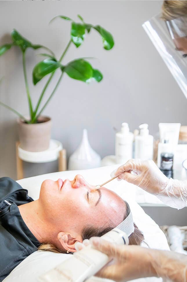 pigmentation-dermelan-treatment