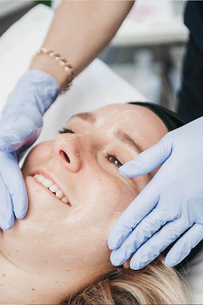 microneedling