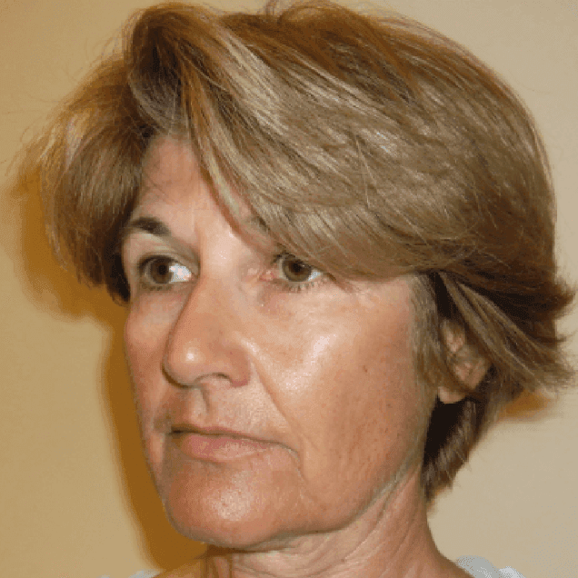 Harley-Street-Silhouette-Soft