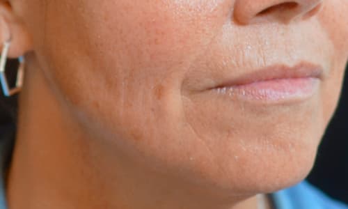 before-after-julaine