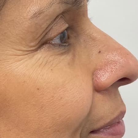 polynucleotides-before-after