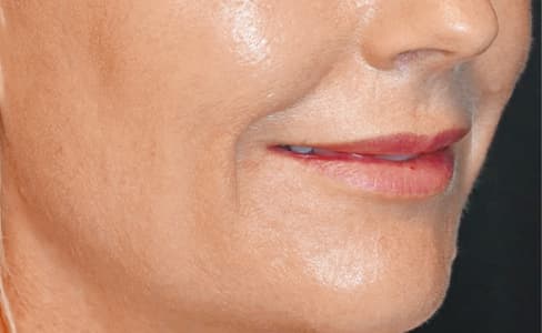 Julaine-results-harley-street