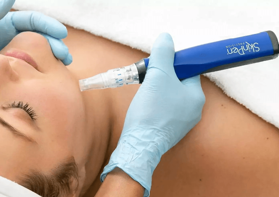 skinpen-female-treatment