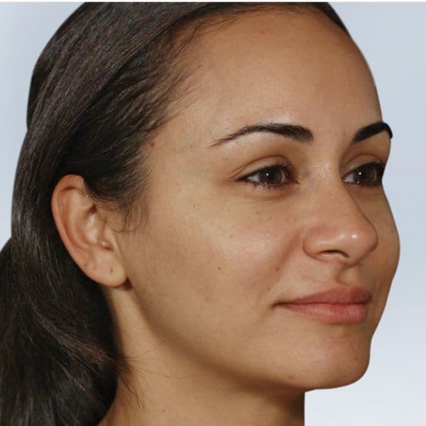 Michelle-after-1-month