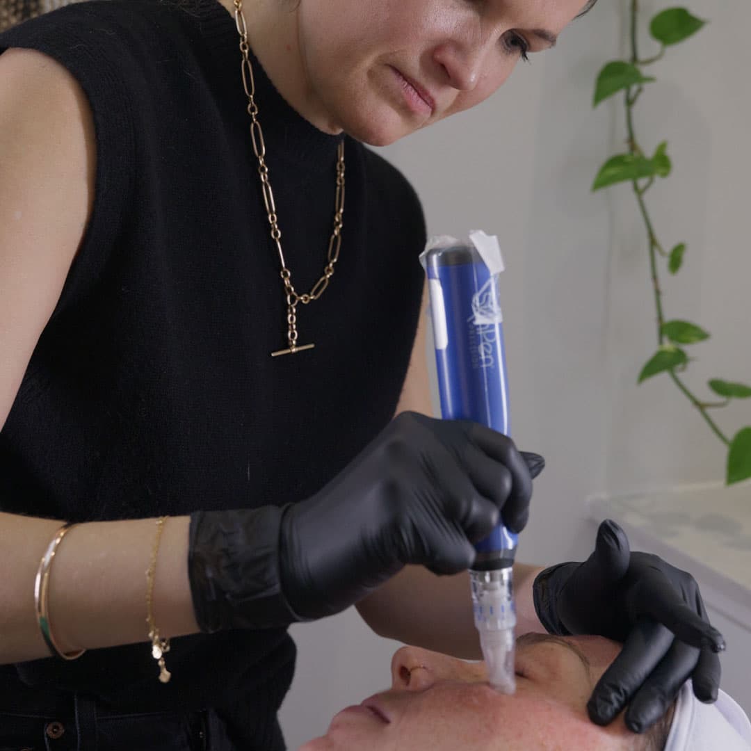 skin-pen-harley-street